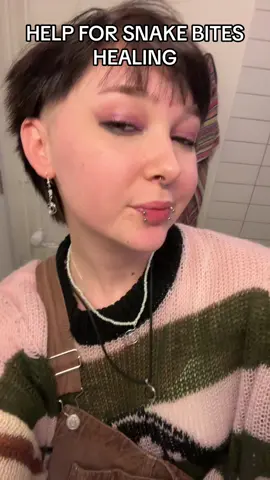 I’m scared they’re gonna migrate out of my face ngl #snakebites #snakebitepiercings #piercing #piercinghealing #healingprocess #hethey #lgbt #transmasc #foryou 