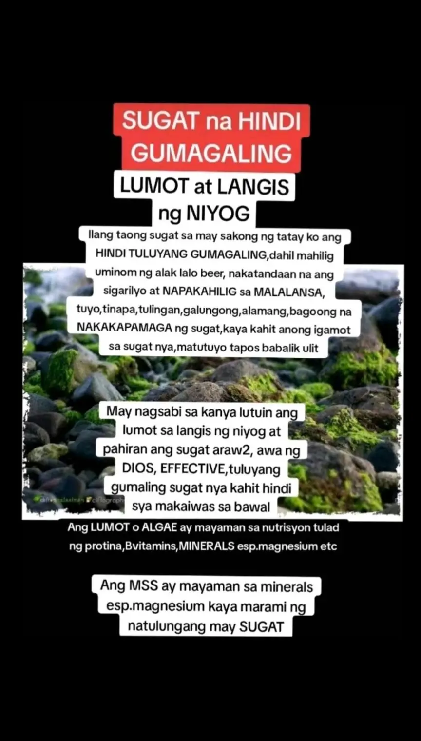 Ano nga ba ang MSS o MAGNESIUM SALT SPRAY? Ito ay pinagsama-samang nga MINERALS,pangunahin ang MAGNESIUM, na inilagay sa isang bote at ipinapahid lang sa BALAT o sa apektadong bahagi,NAPAKALAKI ng kinalaman ng pagkakaroon ng ibat-ibang karamdaman kapag NAWAWALAN ng SAPAT na MINERALS o kaya hindi ito balanse, kaya kapag nabigyan mo ng sapat na minerals ang katawan mo kusang magsisiwalaanbang mga nararamdaman dahil naa-ACTIVATE nito ang NATURAL HEALING MECHANISM,lalo Kong masasabayan ng iba pang mga bitamina lalo ng mayaman sa Bvitamins o Bcomplex,at SAPAT na inom ng tubig,tulog at ehersisyo at makapag paaraw, alisin ang galit sa puso, piliin laging sumaya. Ang kahit anong karamdaman ay maaring GUMALING kapag naibigay mo ang kakailanganin ng iyong katawan. #MSS  #allinone #miraclespray #NATURALnaPANLUNAS #MAGNESIUMsaltSPRAY #naturalnapanlunasadvocate #pisikpisiktanggalangmgasakit #TRANSDERMALmineralSUPPLEMENT#foryou #health 