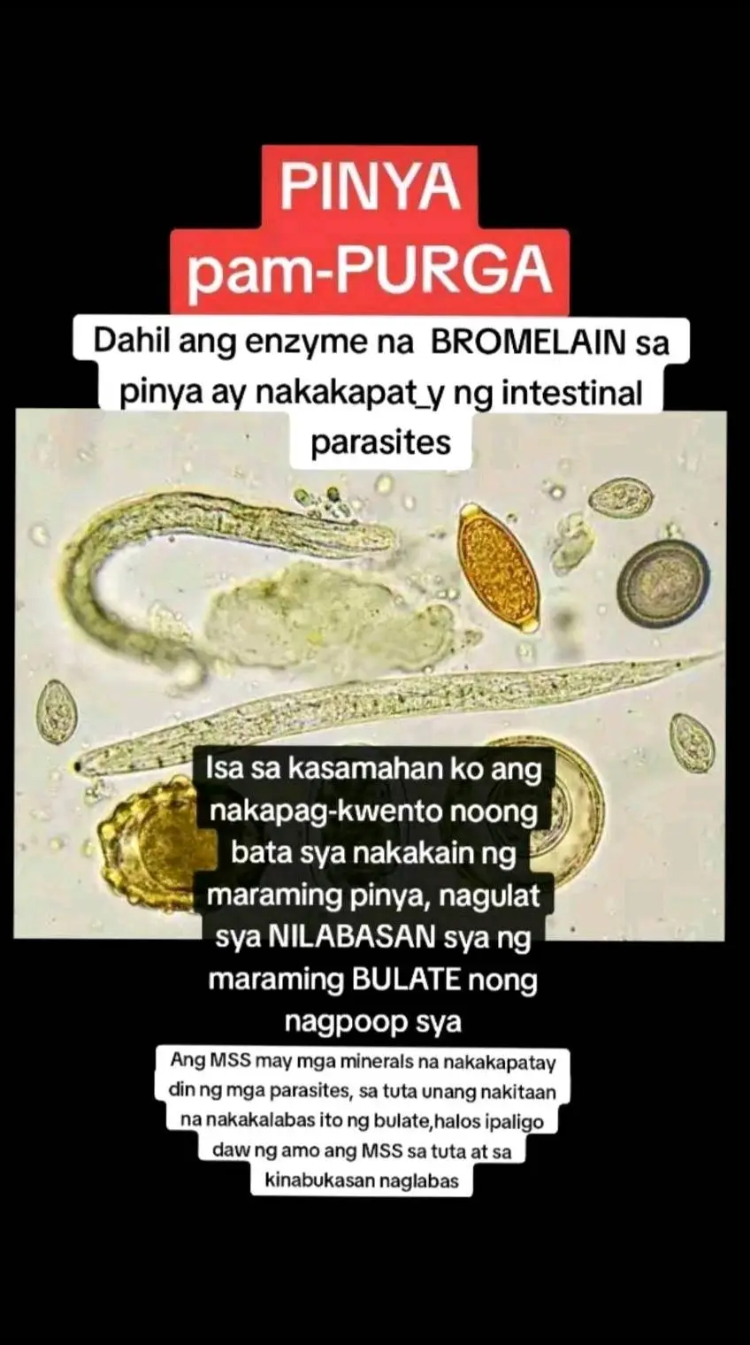 Ano nga ba ang MSS o MAGNESIUM SALT SPRAY? Ito ay pinagsama-samang nga MINERALS,pangunahin ang MAGNESIUM, na inilagay sa isang bote at ipinapahid lang sa BALAT o sa apektadong bahagi,NAPAKALAKI ng kinalaman ng pagkakaroon ng ibat-ibang karamdaman kapag NAWAWALAN ng SAPAT na MINERALS o kaya hindi ito balanse, kaya kapag nabigyan mo ng sapat na minerals ang katawan mo kusang magsisiwalaanbang mga nararamdaman dahil naa-ACTIVATE nito ang NATURAL HEALING MECHANISM,lalo Kong masasabayan ng iba pang mga bitamina lalo ng mayaman sa Bvitamins o Bcomplex,at SAPAT na inom ng tubig,tulog at ehersisyo at makapag paaraw, alisin ang galit sa puso, piliin laging sumaya. Ang kahit anong karamdaman ay maaring GUMALING kapag naibigay mo ang kakailanganin ng iyong katawan. #MSS  #allinone #miraclespray #NATURALnaPANLUNAS #MAGNESIUMsaltSPRAY #naturalnapanlunasadvocate #pisikpisiktanggalangmgasakit #TRANSDERMALmineralSUPPLEMENT#foryou #health 