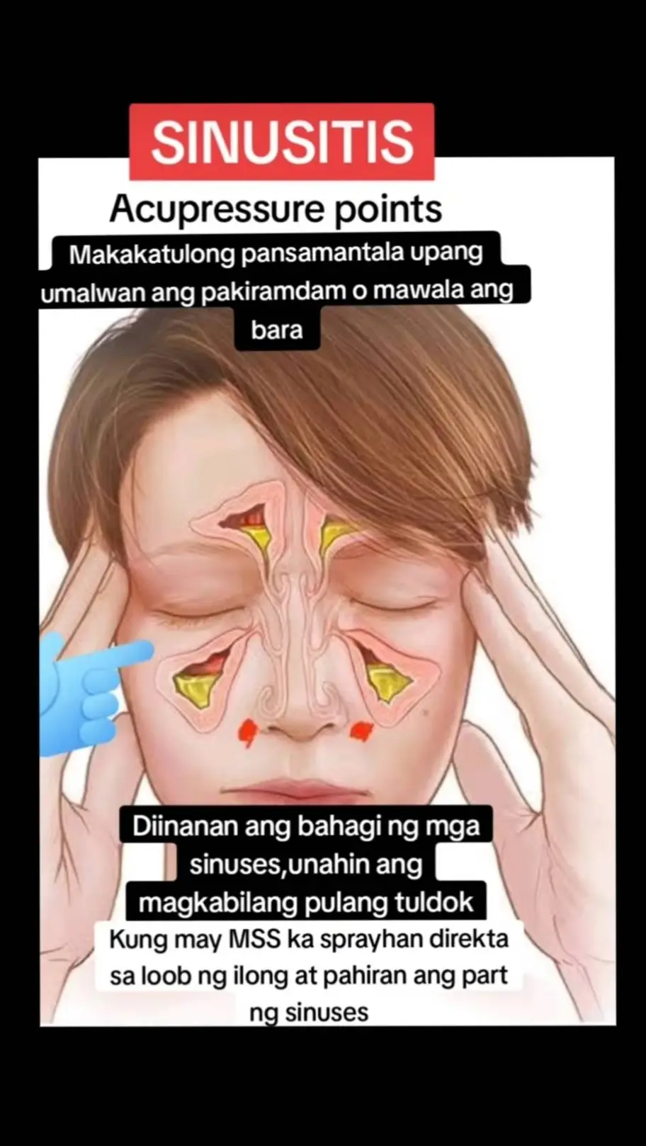 Ano nga ba ang MSS o MAGNESIUM SALT SPRAY? Ito ay pinagsama-samang nga MINERALS,pangunahin ang MAGNESIUM, na inilagay sa isang bote at ipinapahid lang sa BALAT o sa apektadong bahagi,NAPAKALAKI ng kinalaman ng pagkakaroon ng ibat-ibang karamdaman kapag NAWAWALAN ng SAPAT na MINERALS o kaya hindi ito balanse, kaya kapag nabigyan mo ng sapat na minerals ang katawan mo kusang magsisiwalaanbang mga nararamdaman dahil naa-ACTIVATE nito ang NATURAL HEALING MECHANISM,lalo Kong masasabayan ng iba pang mga bitamina lalo ng mayaman sa Bvitamins o Bcomplex,at SAPAT na inom ng tubig,tulog at ehersisyo at makapag paaraw, alisin ang galit sa puso, piliin laging sumaya. Ang kahit anong karamdaman ay maaring GUMALING kapag naibigay mo ang kakailanganin ng iyong katawan. #MSS  #allinone #miraclespray #NATURALnaPANLUNAS #MAGNESIUMsaltSPRAY #naturalnapanlunasadvocate #pisikpisiktanggalangmgasakit #TRANSDERMALmineralSUPPLEMENT#foryou #health 