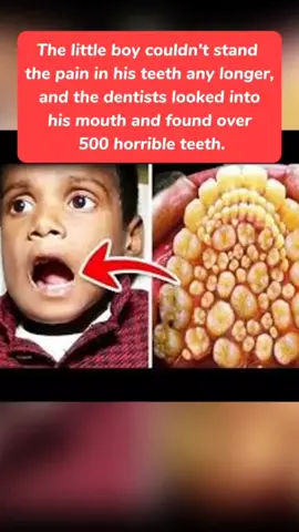 #randomfacts #tiktok #crazy #amazing #foryou 