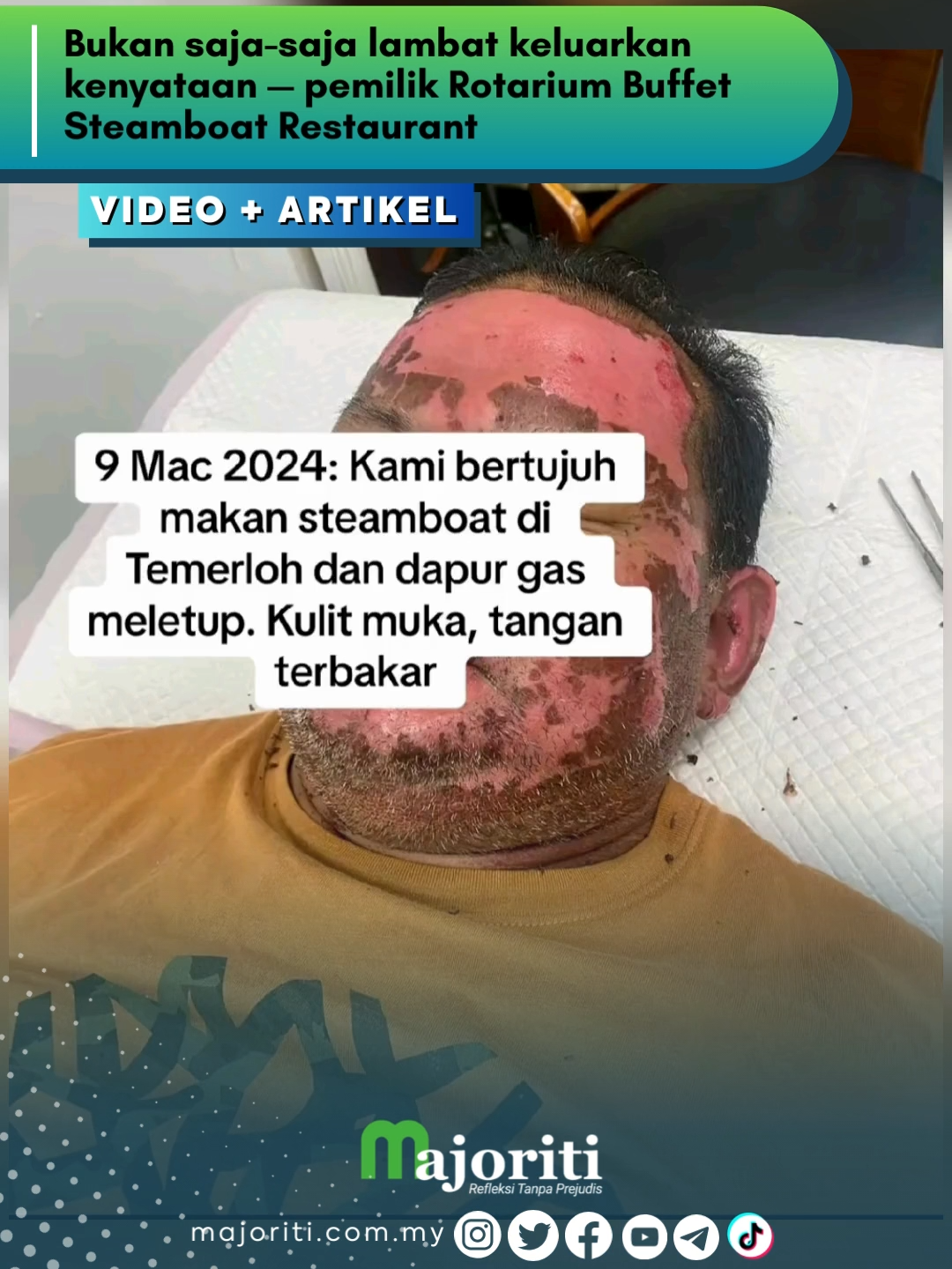 Kesian tengok mereka sekeluarga cedera, memang melecur teruk kulit muka tu :(  #majoriti #beritaditiktok #trendingnewsmalaysia #rotariumsteamboat #pahang #melecur #steamboat #bufet