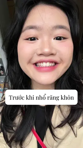 🤟#tiktokgiaitri 