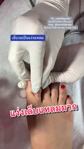 💓 #namthipnails #ตัดเล็บขบ #ตัดหนัง #ทำเล็บ #ร้านตัดเล็บขบ #ร้านตัดเล็บขบราม2 #ร้านทําเล็บ #เล็บขบ  #เล็บเชื้อรา Fb : namthipnails  Line : @namthipnails  นัมเบอร์วัน8 ตลาดม.ราม2  กทม  Map: namthipnails  https://goo.gl/maps/JmwpCKLfKwmhKGK96  ร้านเปิดทุกวัน เวลา12.00น-22.00น.