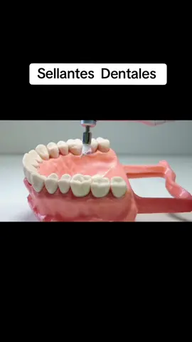 Sellantes Dentales #sellantesdentales #odontopediatra #prevention #guayaquil_ecuador #consultoriodental #odontologa #consultorio #odonto #sauces #odontologia #consultorioodontologico 