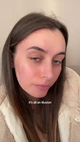 #acne #acneskin #acnefighter #acnepositivity #acnejourney 