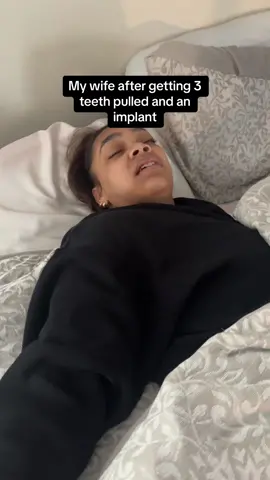 Literally was her 1st time going in 15 years… and who knew she liked fries so much 😅😂 #beefingwithmywife #beefingwiththeblacks #wisdomteeth #viralvideo #reaction #dentistsoftiktok 