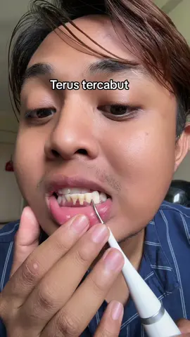 yang tak suka pergi scalling , korang bole try pakai dental scaler ni.                                 #berusgigielektrik #scalingteeth