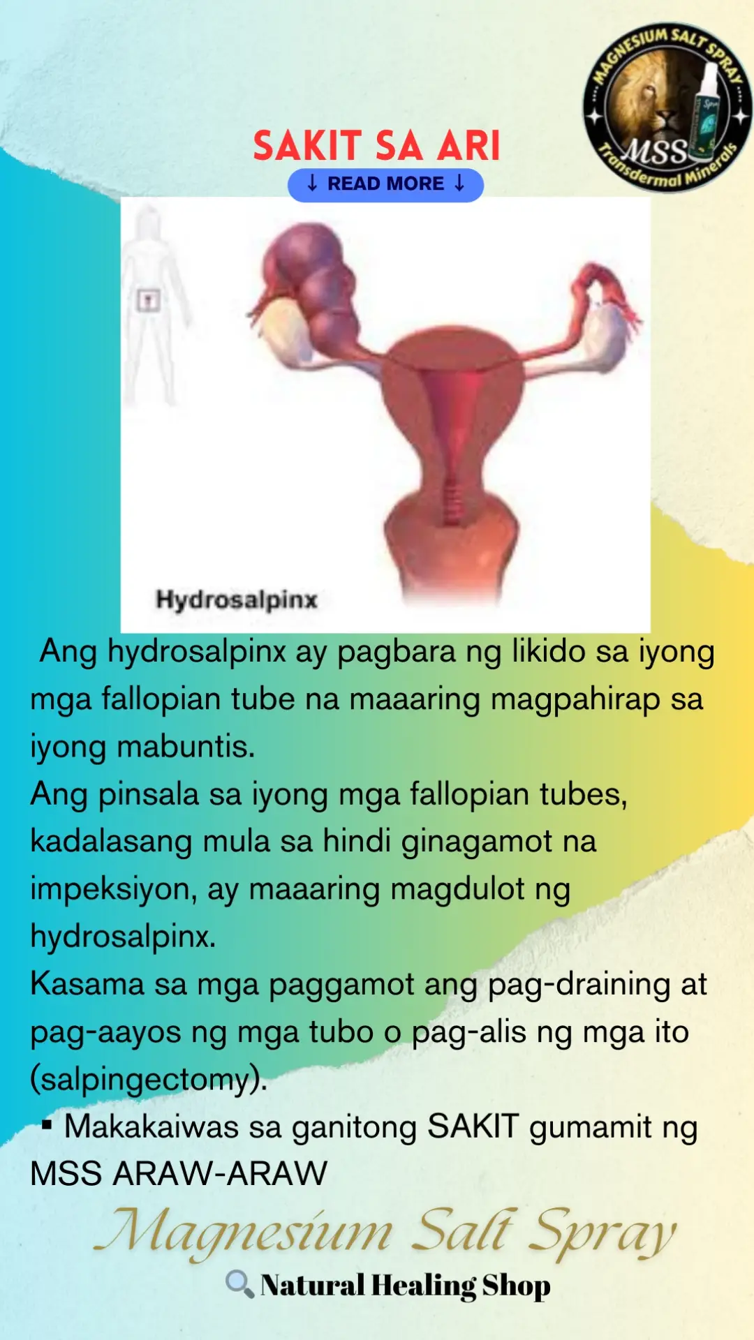 Ano nga ba ang MSS o MAGNESIUM SALT SPRAY? Ito ay pinagsama-samang nga MINERALS,pangunahin ang MAGNESIUM, na inilagay sa isang bote at ipinapahid lang sa BALAT o sa apektadong bahagi,NAPAKALAKI ng kinalaman ng pagkakaroon ng ibat-ibang karamdaman kapag NAWAWALAN ng SAPAT na MINERALS o kaya hindi ito balanse, kaya kapag nabigyan mo ng sapat na minerals ang katawan mo kusang magsisiwalaanbang mga nararamdaman dahil naa-ACTIVATE nito ang NATURAL HEALING MECHANISM,lalo Kong masasabayan ng iba pang mga bitamina lalo ng mayaman sa Bvitamins o Bcomplex,at SAPAT na inom ng tubig,tulog at ehersisyo at makapag paaraw, alisin ang galit sa puso, piliin laging sumaya. Ang kahit anong karamdaman ay maaring GUMALING kapag naibigay mo ang kakailanganin ng iyong katawan. #MSS  #allinone #miraclespray  #NATURALnaPANLUNAS  #MAGNESIUMsaltSPRAY  #naturalnapanlunasadvocate  #pisikpisiktanggalangmgasakit  #TRANSDERMALmineralSUPPLEMENT  #foryou #health 