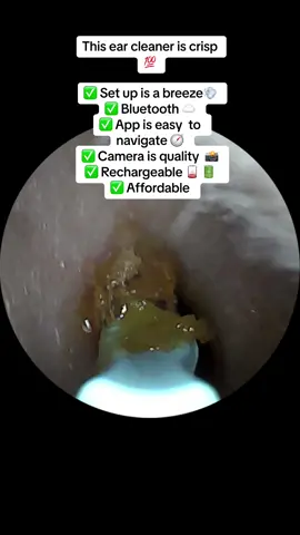 So gross its good. LOVE THIS THING. #earwax #earcleaning #earcamera #earwaxremoval #cantstopwontstop #waxremoval #tiktokshop #tiktoksale #tiktoksamples #tiktokreviews #tiktokreview #adhd #asd #mynewhobby #addictedtothis #MomsofTikTok #momsover30 #nursesoftiktok #nursesoftiktokhavingfun #buy #buythis #buythisnotthat #buythisnow #buythisproduct #CapCut @Noelle Fillmore 