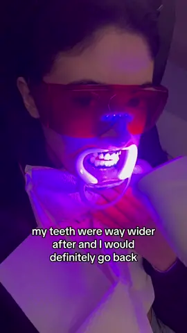 @We Whiten ily ❤️ #teethwhiteninghack #teethwhiten #viral 