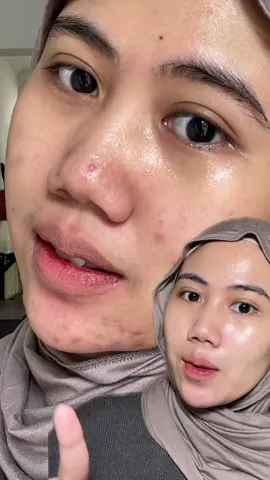 Harusnya emang pake dua duanya sih dari dulu 😩 #gentleglowithyou #radianceglow 