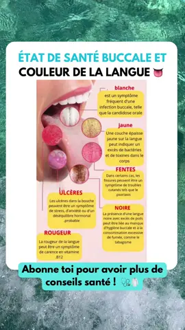 État de santé buccale et couleur de la langue 👅 #langue #bouche #couleurs #sante #wellness #bienetre 