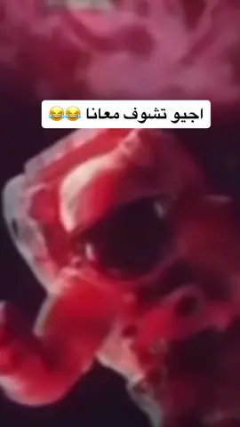 شكون تفضلو 🥰#CapCut #goldhaddaj #bijoutriehaddaj #ذهب #gold #bijoux #الشعب_الصيني_ماله_حل😂 
