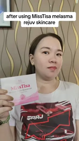 Another satisfied costumer‼️Thank you MissTisa🥰❤️  #melasma #misstisa #melasmatreatment #matildasbeauty #rejuvenatingset #foryoupage 