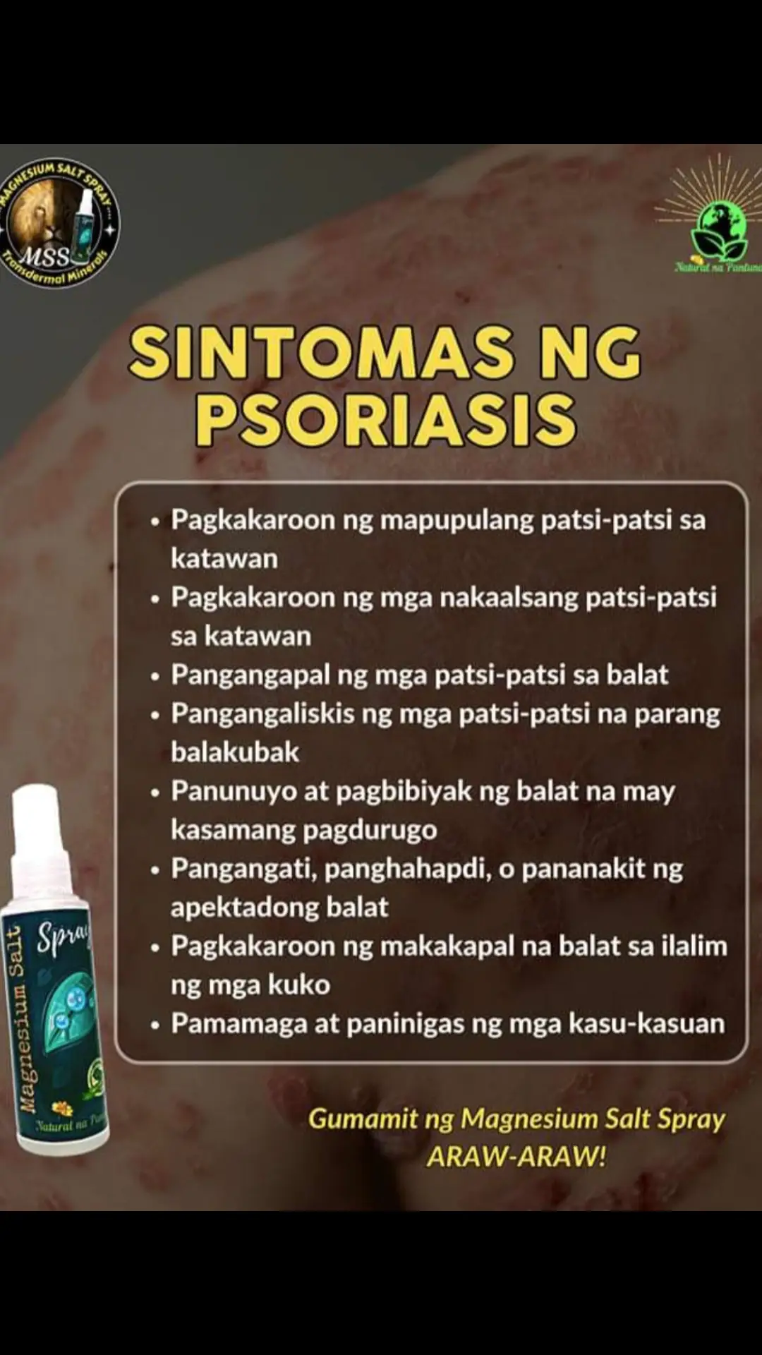 Ano nga ba ang MSS o MAGNESIUM SALT SPRAY? Ito ay pinagsama-samang nga MINERALS,pangunahin ang MAGNESIUM, na inilagay sa isang bote at ipinapahid lang sa BALAT o sa apektadong bahagi,NAPAKALAKI ng kinalaman ng pagkakaroon ng ibat-ibang karamdaman kapag NAWAWALAN ng SAPAT na MINERALS o kaya hindi ito balanse, kaya kapag nabigyan mo ng sapat na minerals ang katawan mo kusang magsisiwalaanbang mga nararamdaman dahil naa-ACTIVATE nito ang NATURAL HEALING MECHANISM,lalo Kong masasabayan ng iba pang mga bitamina lalo ng mayaman sa Bvitamins o Bcomplex,at SAPAT na inom ng tubig,tulog at ehersisyo at makapag paaraw, alisin ang galit sa puso, piliin laging sumaya. Ang kahit anong karamdaman ay maaring GUMALING kapag naibigay mo ang kakailanganin ng iyong katawan. #MSS  #allinone #miraclespray  #NATURALnaPANLUNAS  #MAGNESIUMsaltSPRAY  #naturalnapanlunasadvocate  #pisikpisiktanggalangmgasakit  #TRANSDERMALmineralSUPPLEMENT  #foryou #health 