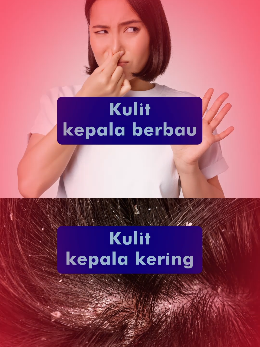 Stres dengan masalah rambut anda? Jangan risau, dengan Selsun Blue Advanced Oil Control Shampoo terbaru rambut anda akan jadi lebih sihat. Tukarlah kepada Selsun Blue hari ini!​ #TrustInSelsunBlue #PakarKelemumur