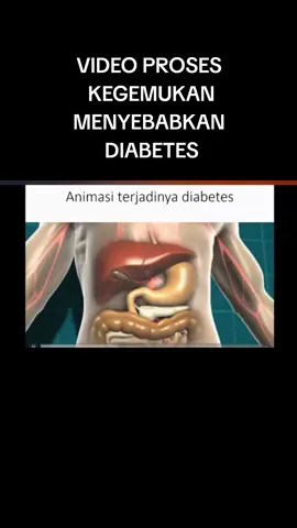 video animasi resistensi insulin karena kebanyakan lemak dalam tubuh dr. Andri # #diabetes #guladarah #baal #resistensiinsulin #komplikasi #insulin #kegemukan #obesitas 