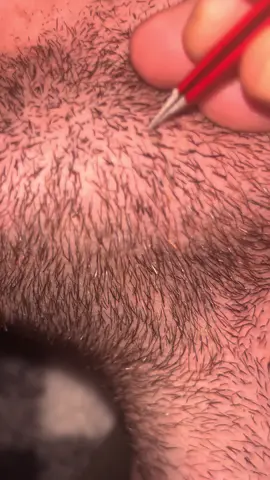 The saga continues on the mega bitch hair