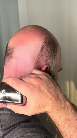 No mess, no cuts just bald. #bald #baldmen #shave #shavedhead #razor #electricrazor #skullshaver #mensgrooming 