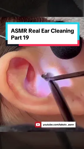 ASMR Real Ear Cleaning | Part 19 #asmr #earcleaning #earwax #foryou #foryoupage #耳掃除 #귀청소 #采耳 #asmrsound #asmrtiktoks #asmrrealperson #asmrrelax #asmrsleep #ear #earwaxremoval #earcleaningasmr #耳垢 #耳くそ #耳子 #気持ちいい瞬間 #귀청소asmr #relax #relaxingvideos #relaxingsounds #sleep #satisfying #satisfyingvideo