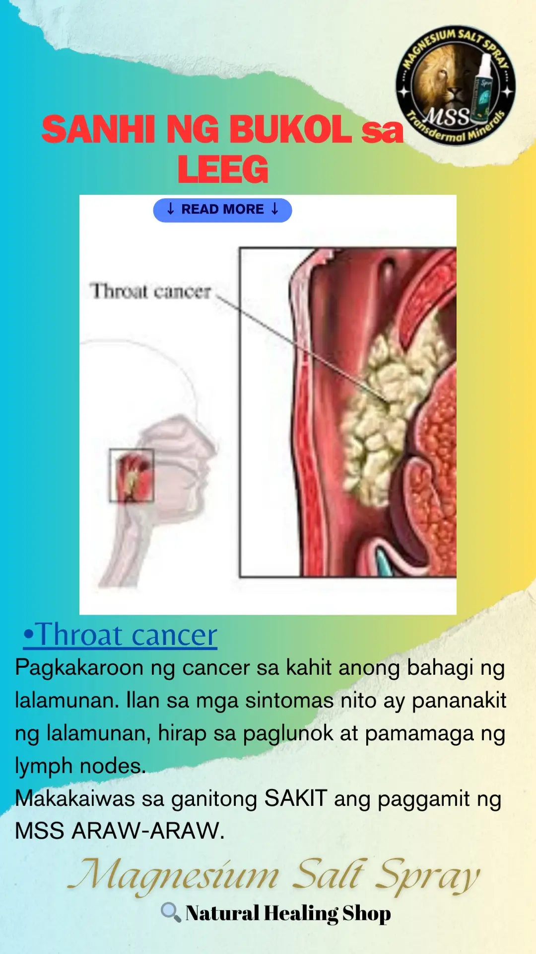 Ano nga ba ang MSS o MAGNESIUM SALT SPRAY? Ito ay pinagsama-samang nga MINERALS,pangunahin ang MAGNESIUM, na inilagay sa isang bote at ipinapahid lang sa BALAT o sa apektadong bahagi,NAPAKALAKI ng kinalaman ng pagkakaroon ng ibat-ibang karamdaman kapag NAWAWALAN ng SAPAT na MINERALS o kaya hindi ito balanse, kaya kapag nabigyan mo ng sapat na minerals ang katawan mo kusang magsisiwalaanbang mga nararamdaman dahil naa-ACTIVATE nito ang NATURAL HEALING MECHANISM,lalo Kong masasabayan ng iba pang mga bitamina lalo ng mayaman sa Bvitamins o Bcomplex,at SAPAT na inom ng tubig,tulog at ehersisyo at makapag paaraw, alisin ang galit sa puso, piliin laging sumaya. Ang kahit anong karamdaman ay maaring GUMALING kapag naibigay mo ang kakailanganin ng iyong katawan. #MSS  #allinone #miraclespray  #NATURALnaPANLUNAS  #MAGNESIUMsaltSPRAY  #naturalnapanlunasadvocate  #pisikpisiktanggalangmgasakit  #TRANSDERMALmineralSUPPLEMENT  #foryou #health #magandangprodukto 