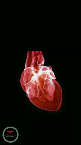 Heart Arrhythmia ( Irregular heart rhythms ) #arrhythmia #fyp #foryou