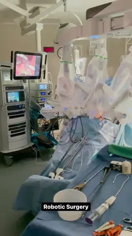 Is this Sci-Fi?  No!!! This is what I do every week!  Robotic Surgery is Amazing!!! When I started my surgical residency over 20 years ago I NEVER thought 💭 I would operate like this!!!  Robotic surgery is so very safe and more meticulous than performing surgery open or even laparoscopic.  You can move the fine tips of the instruments which oftentimes are only around a cm long to carefully handle organs gently.  I’ve been doing robotics for so long that I actually can feel but with my eyes 👀 not my hands!  Our brains are amazing that way!!!  The great thing with robotics (since I am a control freak) is that I can control the camera 🎥 and the three working arms.  I can do this all with 3D vision at the console. Although it looks scary that the patient is alone at the bedside they are not.  The anesthesia provider is at the head of the bed and the surgical technologist and first assistant is at the bedside.  There are so many fail safes built into the robot 🤖 that it cannot make any movements not directly controlled by me otherwise it will shut down.  What it does allow me to do is access areas that once were difficult to reach even open and do fine dissections especially at the diaphragm right next to heart, aorta, esophagus with amazing precision!!! #roboticsurgery #robotics #roboticbariatricsurgery #roboticsurgeon #vsg #vsgcommunity #femalesurgeon #womensurgeons #operatingroom #bariatricsurgery #bariatricsleeve #gastricsleeve #gastricsleevesurgery #keepingitsafe #doctorsofinstagram #orlife #lifechanging #nicolebasamd #austintx #austintexas #surgicalweightloss #cedarparktx #cuttingedge #gastricbypass #gettinghealthy #gettinghealthier #bariatricsurgeon #bestbariatricsurgeon #bamedicalcenter 