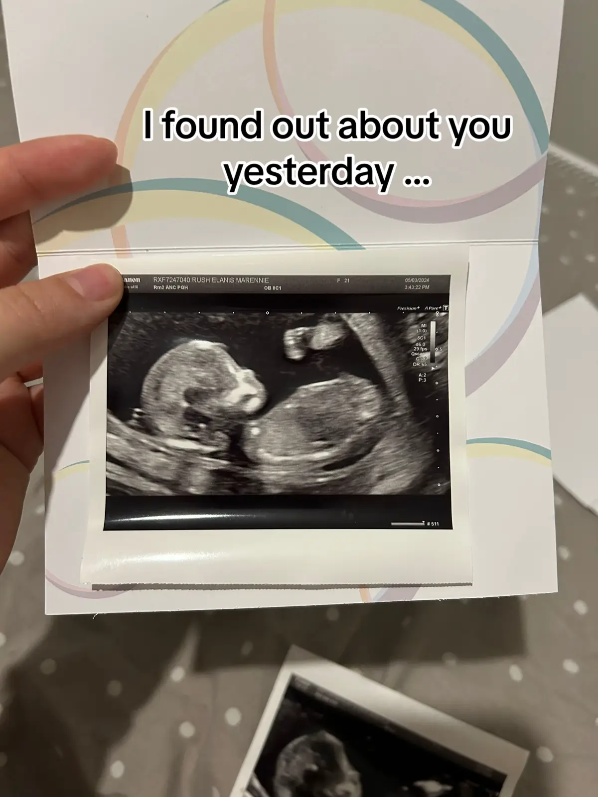 #baby #babylove #babytiktok #babyannouncement #babyannouncements 