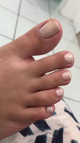 Vem conferir esse antes e depois de pedicure 😱😍  #unhasdecoradas #pes #unhasdospés #manicure #trending #viral #tiktok 