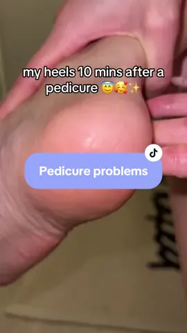 🙃 I just want it to last a day…. #girlprobs #justgirlythings #relatable #fyp #dryheels #smoothheels #pedicure #pedicureproblems