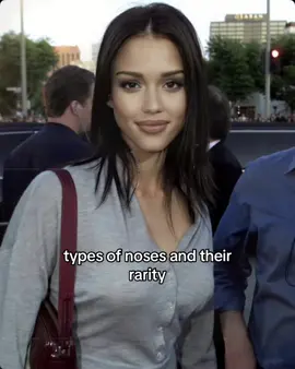 types of noses and their rarity #fyp #foryou #viral #nose #nosetypes #typesofnoses #rarenoses #rare #types #rarity #noses #percent #percentofnoses #straightnose #buttonnose #upturnednose #greeknose 