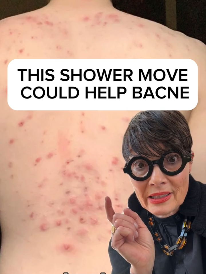 This shower move could help with #bacne #showertips #hygienetips