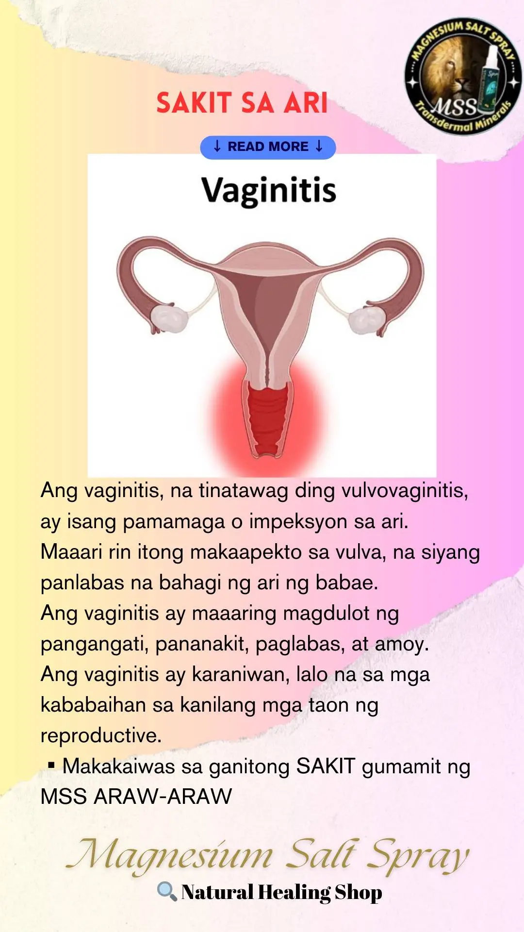 Ano nga ba ang MSS o MAGNESIUM SALT SPRAY? Ito ay pinagsama-samang nga MINERALS,pangunahin ang MAGNESIUM, na inilagay sa isang bote at ipinapahid lang sa BALAT o sa apektadong bahagi,NAPAKALAKI ng kinalaman ng pagkakaroon ng ibat-ibang karamdaman kapag NAWAWALAN ng SAPAT na MINERALS o kaya hindi ito balanse, kaya kapag nabigyan mo ng sapat na minerals ang katawan mo kusang magsisiwalaanbang mga nararamdaman dahil naa-ACTIVATE nito ang NATURAL HEALING MECHANISM,lalo Kong masasabayan ng iba pang mga bitamina lalo ng mayaman sa Bvitamins o Bcomplex,at SAPAT na inom ng tubig,tulog at ehersisyo at makapag paaraw, alisin ang galit sa puso, piliin laging sumaya. Ang kahit anong karamdaman ay maaring GUMALING kapag naibigay mo ang kakailanganin ng iyong katawan. #MSS  #allinone #miraclespray  #NATURALnaPANLUNAS  #MAGNESIUMsaltSPRAY  #naturalnapanlunasadvocate  #pisikpisiktanggalangmgasakit  #TRANSDERMALmineralSUPPLEMENT  #foryou #health #magandangprodukto 