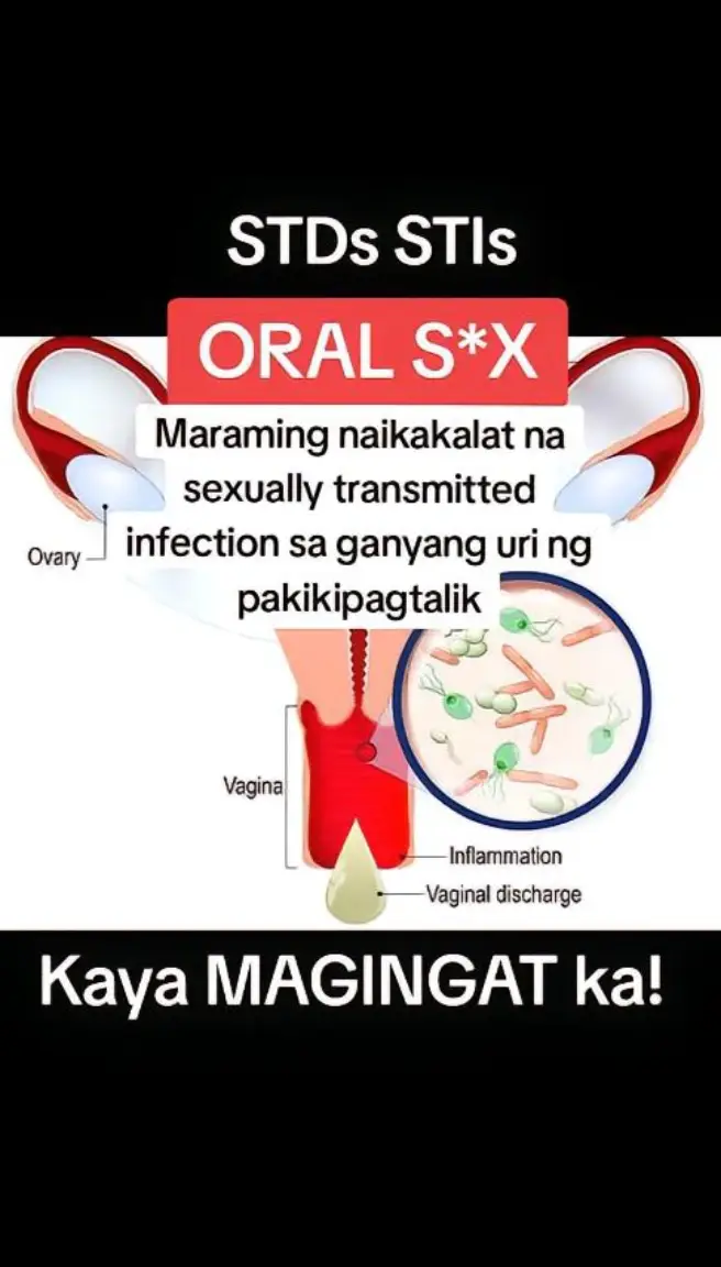 Ano nga ba ang MSS o MAGNESIUM SALT SPRAY? Ito ay pinagsama-samang nga MINERALS,pangunahin ang MAGNESIUM, na inilagay sa isang bote at ipinapahid lang sa BALAT o sa apektadong bahagi,NAPAKALAKI ng kinalaman ng pagkakaroon ng ibat-ibang karamdaman kapag NAWAWALAN ng SAPAT na MINERALS o kaya hindi ito balanse, kaya kapag nabigyan mo ng sapat na minerals ang katawan mo kusang magsisiwalaanbang mga nararamdaman dahil naa-ACTIVATE nito ang NATURAL HEALING MECHANISM,lalo Kong masasabayan ng iba pang mga bitamina lalo ng mayaman sa Bvitamins o Bcomplex,at SAPAT na inom ng tubig,tulog at ehersisyo at makapag paaraw, alisin ang galit sa puso, piliin laging sumaya. Ang kahit anong karamdaman ay maaring GUMALING kapag naibigay mo ang kakailanganin ng iyong katawan. #MSS  #allinone #miraclespray  #NATURALnaPANLUNAS  #MAGNESIUMsaltSPRAY  #naturalnapanlunasadvocate  #pisikpisiktanggalangmgasakit  #TRANSDERMALmineralSUPPLEMENT  #foryou #health #magandangprodukto #