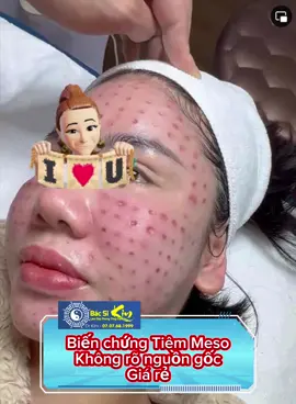 Thương ghê !  Tình trạng u hạt biến chứng trong tiêm meso không đúng kỹ thuật và sử dụng sai sản phẩm trên nền da của khách hàng 🥲 Không phải cứ mua về là tiêm ào được nhé Có kiến thức kinh nghiệm và tuyệt đối vô khuẩn cao Cứ ham rẻ và kết quả như thế là xong#xuhuong #xyzbca 