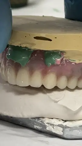 Denture Relining from Start to Finish! #tiktok #tiktokvideo #fyp #dentaltok #dentistoftiktok #tiktokdentist #dental #dentalart #dentist #DentalTech #dentaltechnician #DentalTechnology #denture #dentures #reline #relining #starttofinish #start #finish #lsk121 #lsk121oralprosthetics #lukekahng 