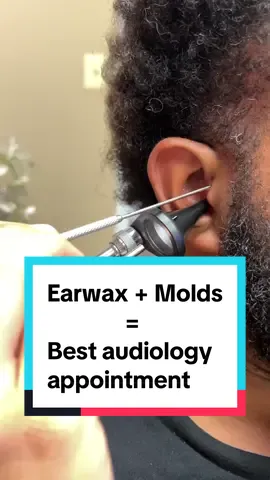 Earwax + custom molds = my favorite type of audiology appointment ❤️❤️ This musician left with a smile on his face! #earcleaning #earwax #hearingprotection #custommade #wax #musician #noiseinducedhearingloss #audiology #audiologist 
