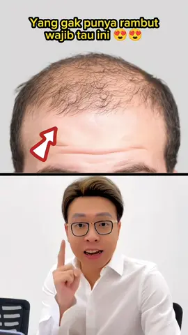 Minyak penumbuh rambut atasi kebotakan