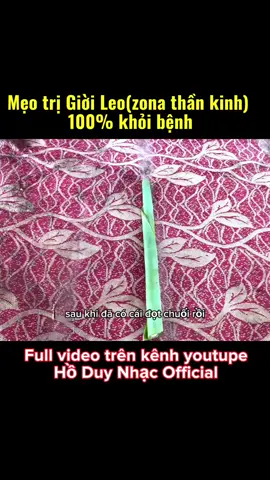 Mẹo trị Giời Leo(Zona thần kinh) 100% khỏi bệnh.Ai cũng nên xem và lưu lại khi cần #baithuocdangian #baithuochay #caythuocvuonnha 