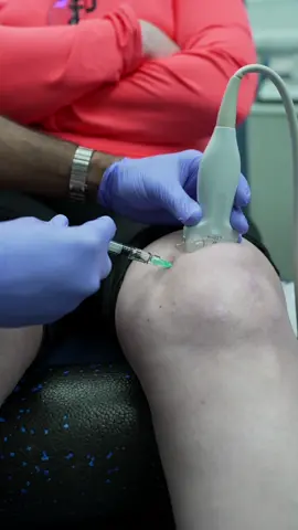 Gel injections for the knee involve the injection of a gel-like substance into the knee joint to provide lubrication and cushioning. This treatment is often used to alleviate pain and improve mobility in patients with knee osteoarthritis by replenishing the natural lubricant lost in the joint #painmanagement #osteoarthritis #kneepainrelief 