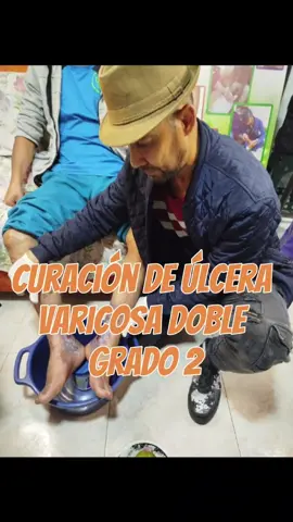 Acompáñame a Curar úlcera Varicosa doble grado 2 #venasvaricosas #hierbasmedicinales #venas #plantas #diabetes #piernas #curacion #venas #varicesyarañitas #tratamiento 