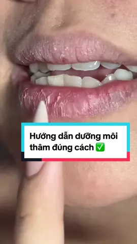 Trả lời @Ngân rì dui tất cả bye bye môi thâm, môi khô thật nhen mấy ní   #BeautyTok #LearnOnTikTok #lipcare #lipcareroutine #môitham #moikho #duongmoi 