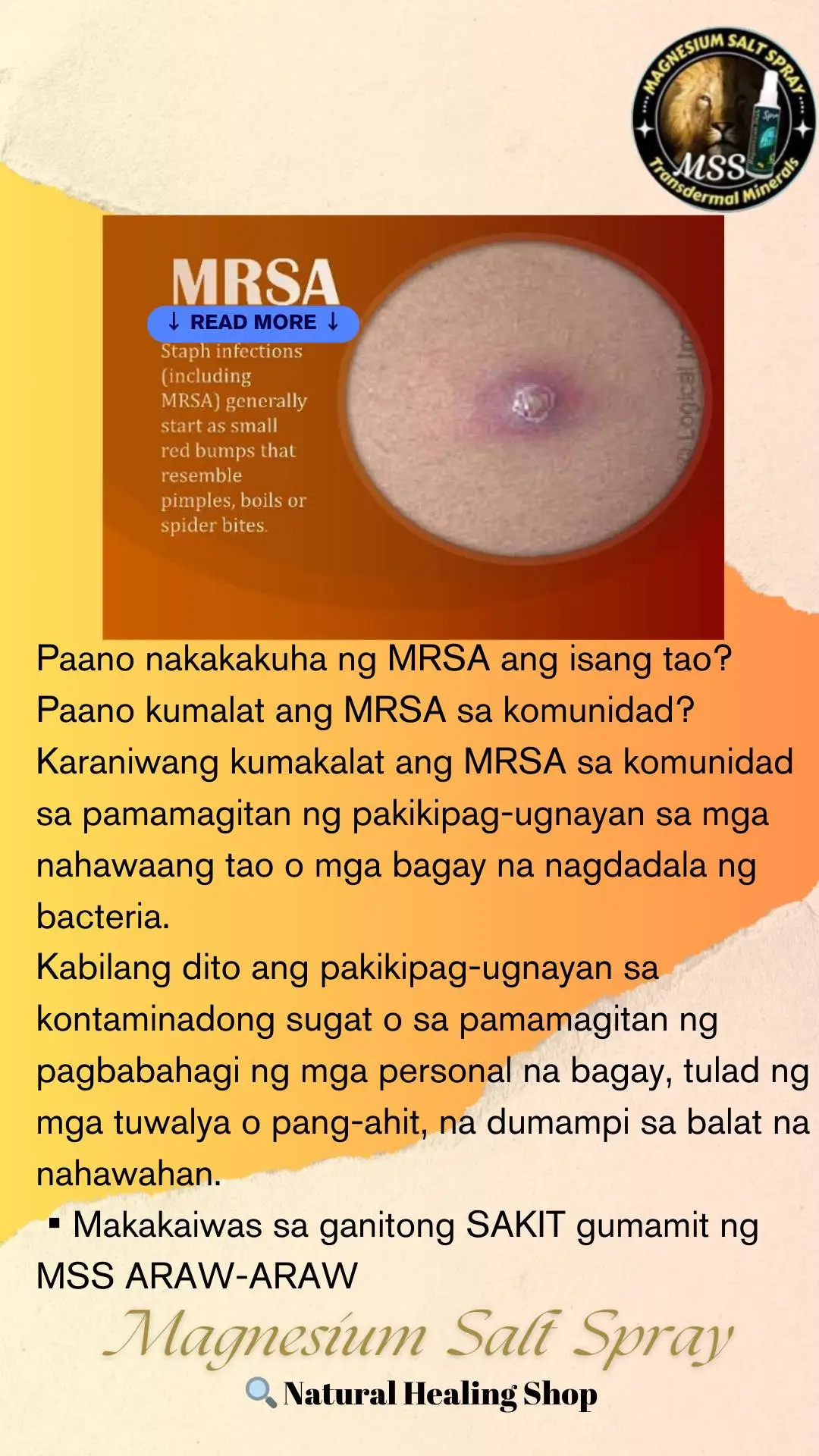 Ano nga ba ang MSS o MAGNESIUM SALT SPRAY? Ito ay pinagsama-samang nga MINERALS,pangunahin ang MAGNESIUM, na inilagay sa isang bote at ipinapahid lang sa BALAT o sa apektadong bahagi,NAPAKALAKI ng kinalaman ng pagkakaroon ng ibat-ibang karamdaman kapag NAWAWALAN ng SAPAT na MINERALS o kaya hindi ito balanse, kaya kapag nabigyan mo ng sapat na minerals ang katawan mo kusang magsisiwalaan ang mga nararamdaman dahil naa-ACTIVATE nito ang NATURAL HEALING MECHANISM,lalo Kong masasabayan ng iba pang mga bitamina lalo ng mayaman sa Bvitamins o Bcomplex,at SAPAT na inom ng tubig,tulog at ehersisyo at makapag paaraw, alisin ang galit sa puso, piliin laging sumaya. Ang kahit anong karamdaman ay maaring GUMALING kapag naibigay mo ang kakailanganin ng iyong katawan. #MSS  #allinone #miraclespray  #NATURALnaPANLUNAS  #MAGNESIUMsaltSPRAY  #naturalnapanlunasadvocate  #pisikpisiktanggalangmgasakit  #TRANSDERMALmineralSUPPLEMENT  #foryou #health #magandangprodukto #keepsafe 