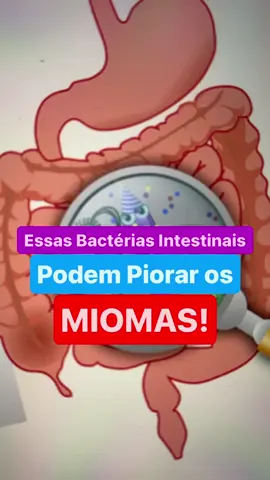 🟢 As bactérias do seu intestino podem piorar os seus Miomas!! 😳😳😳 É isso mesmo que você ouviu!!!  Se o seu intestino estiver em disbiose, ele pode atrapalhar na produção do hormônio que protege nosso útero dos Miomas!!!  Cuide do seu intestino, alimente as bactérias boas que moram nele!!  Agora quero saber de vc!  Você tem um ritmo intestinal bom ou tem intestino preso?  Me conta aqui nos comentários 👇🏻
