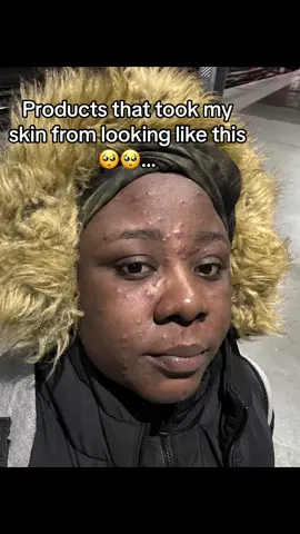 #fyp #newcontentcreator #skincare #skincaretips #trending #newcontent #skincareroutine #uk #uktiktok🇬🇧uk #teamwork #fypシ゚viral #foryourpage #makeuptutorial 