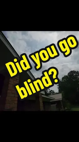 Are you blind?@Margaret Webb #eclipse #mississippieclipse #Mississippi 
