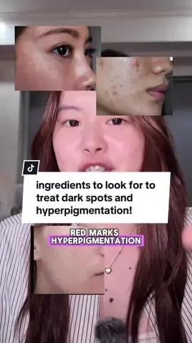 these are all tried and tested based on my experience 👀🩷 #skincare #tips #darkspots #hyperpigmentation #redmarks #acnemarks #serum #effective #brightening #lighten #soulapothecary #skincareingredients #radianceboostserum #alphaarbutin #niacinamide #tranexamicacid 