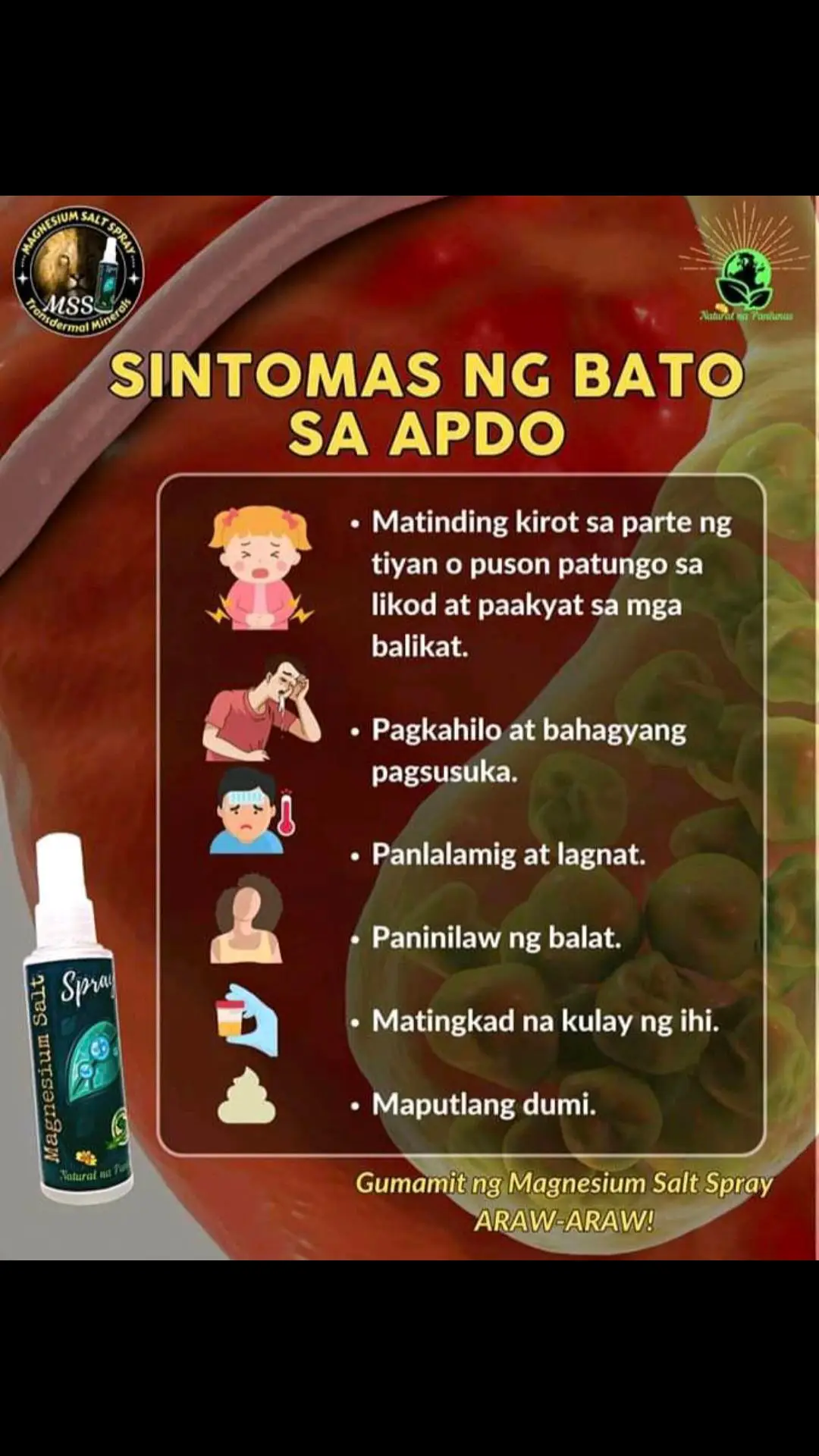 Ano nga ba ang MSS o MAGNESIUM SALT SPRAY? Ito ay pinagsama-samang nga MINERALS,pangunahin ang MAGNESIUM, na inilagay sa isang bote at ipinapahid lang sa BALAT o sa apektadong bahagi,NAPAKALAKI ng kinalaman ng pagkakaroon ng ibat-ibang karamdaman kapag NAWAWALAN ng SAPAT na MINERALS o kaya hindi ito balanse, kaya kapag nabigyan mo ng sapat na minerals ang katawan mo kusang magsisiwalaan ang mga nararamdaman dahil naa-ACTIVATE nito ang NATURAL HEALING MECHANISM,lalo Kong masasabayan ng iba pang mga bitamina lalo ng mayaman sa Bvitamins o Bcomplex,at SAPAT na inom ng tubig,tulog at ehersisyo at makapag paaraw, alisin ang galit sa puso, piliin laging sumaya. Ang kahit anong karamdaman ay maaring GUMALING kapag naibigay mo ang kakailanganin ng iyong katawan. #MSS  #allinone #miraclespray  #NATURALnaPANLUNAS  #MAGNESIUMsaltSPRAY  #naturalnapanlunasadvocate  #pisikpisiktanggalangmgasakit  #TRANSDERMALmineralSUPPLEMENT  #foryou #health #magandangprodukto #keepsafe 