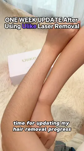 Check out this amazing results 😯 #Ulike #UlikeAir10 #IPL #Hairremoval 